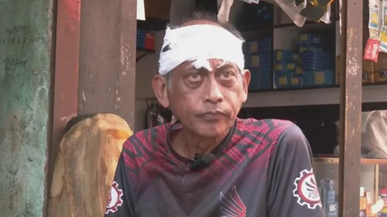 হামলার শিকার অভিনেতা সমু চৌধুরী, মাথায় ৪ সেলাই